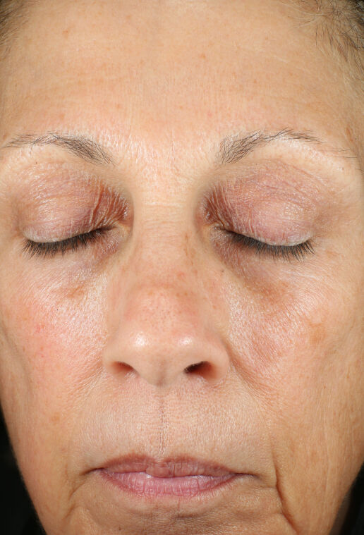 Renewal Crème and Recovery Crème | Product Innovation